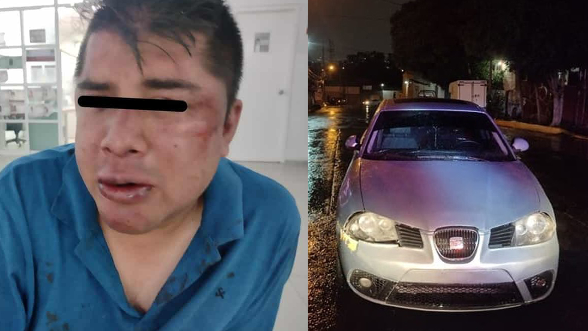 #Video Conductor ebrio atropella en Atizapán a mujer y su bebé - conductor-y-vehiculo-con-el-que-atropello-a-mujer-y-su-bebe-en-atizapan