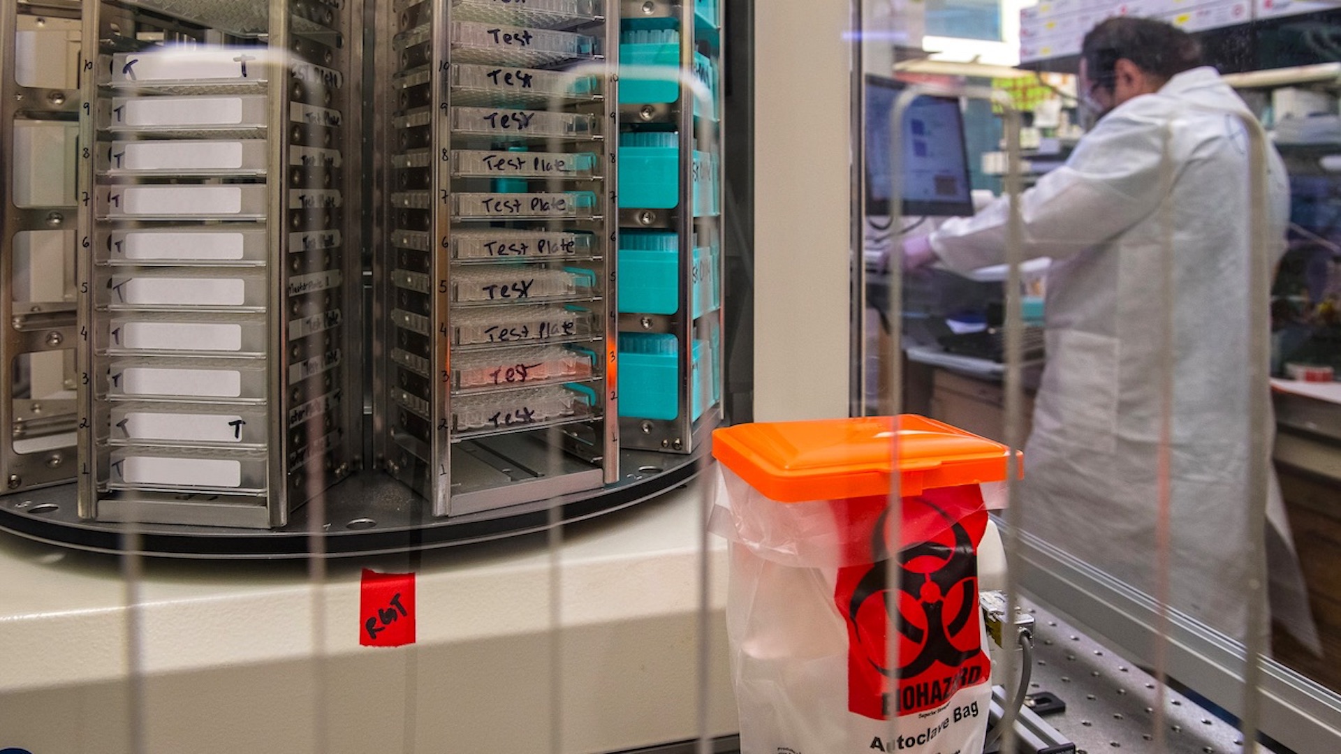 Identifican 13 biomarcadores asociados a la gravedad y propensión del COVID-19 Identifican 13 biomarcadores asociados a la gravedad y propensión del COVID-19