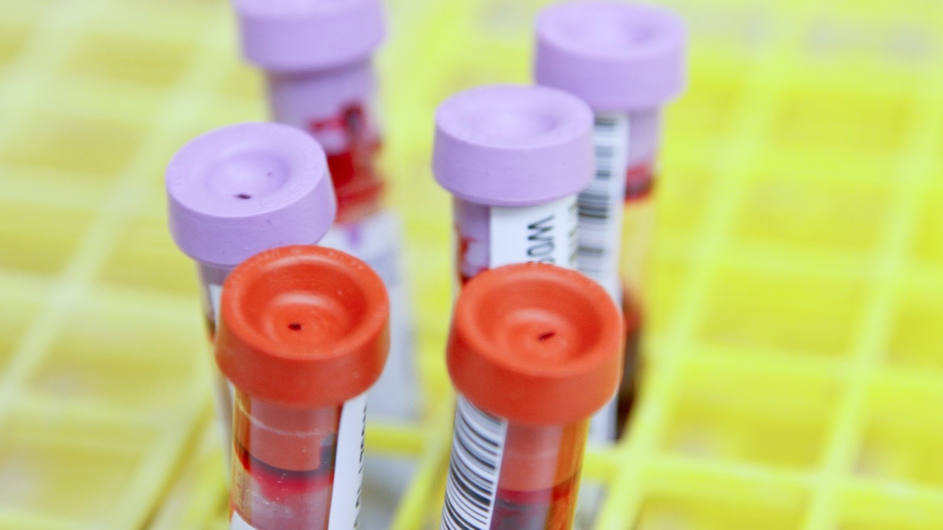 Herpes genital humano evoluciona más rápido que el labial