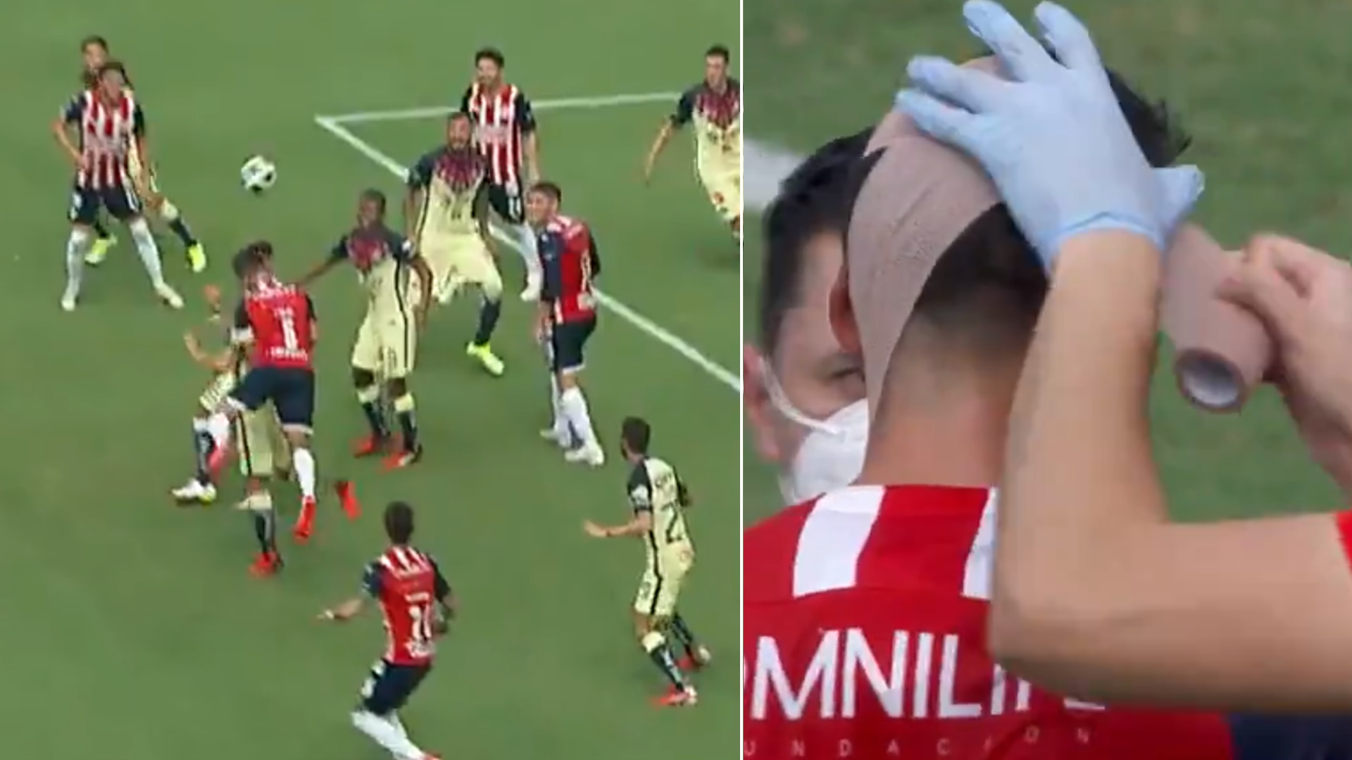#Video Chocan jugadores de Chivas y América en partido amistoso