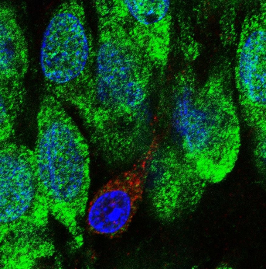 Demuestran existencia de células madre en el hipocampo del cerebro humano - neuronas-inmaduras