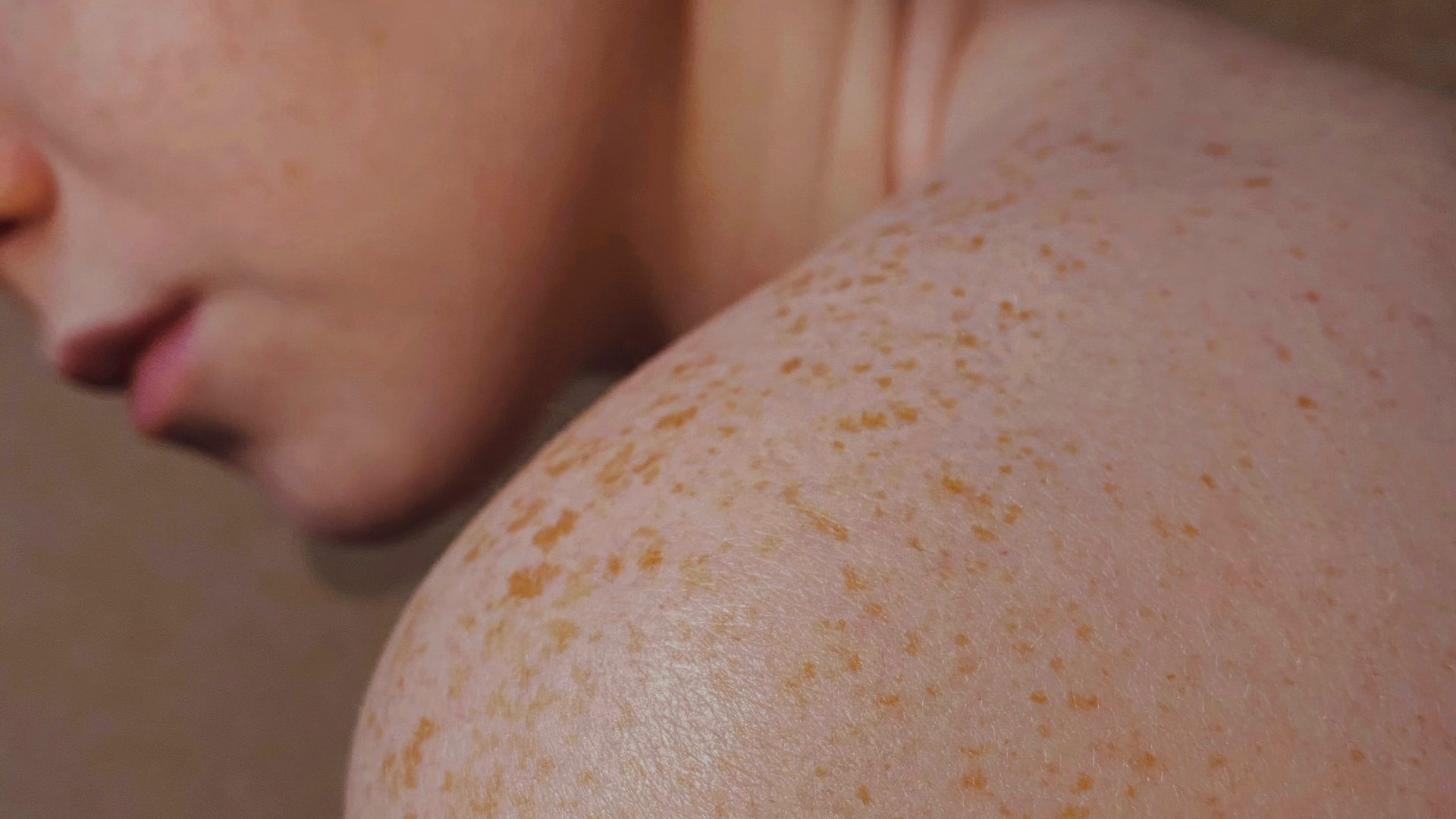 Descubren un mecanismo que causa la metástasis del melanoma y cómo frenarlo Descubren un mecanismo que causa la metástasis del melanoma y cómo frenarlo