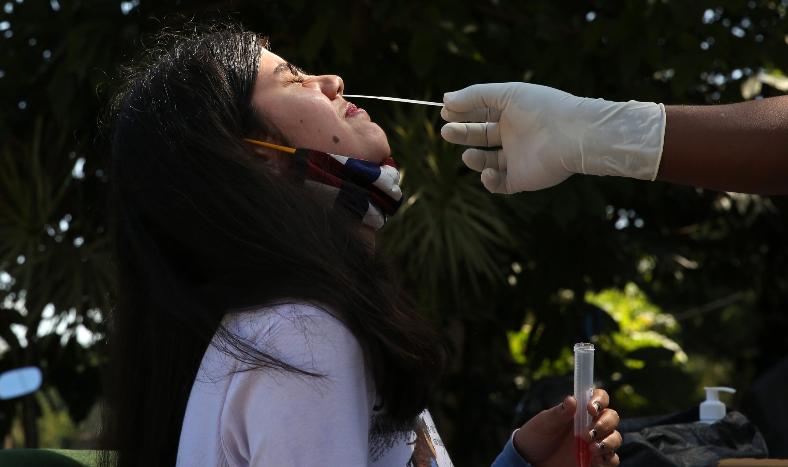 Segundo año de pandemia en América triplicó en casos al primero, confirma OPS