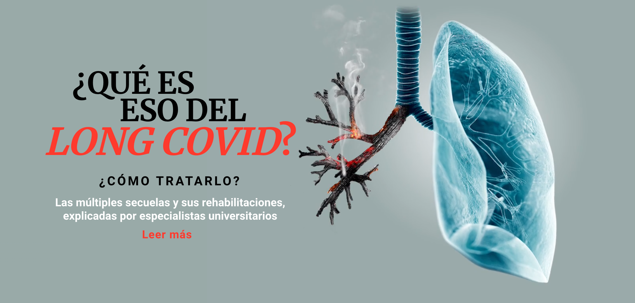 ¿Qué es eso del LONG-COVID? ¿Qué es eso del LONG-COVID?