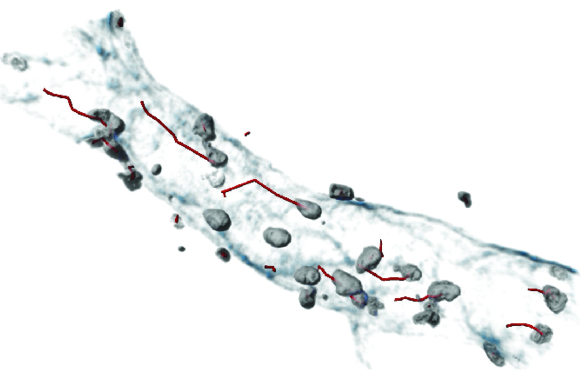 Ciertos tipos de comportamiento celular predicen enfermedades cardiovasculares Ciertos tipos de comportamiento celular predicen enfermedades cardiovasculares