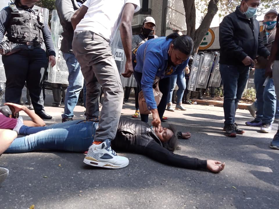 Connato de riña entre policías y migrantes haitianos en CDMX deja una mujer herida - migrante-haitiana-herida-tras-enfrentamiento-con-policias