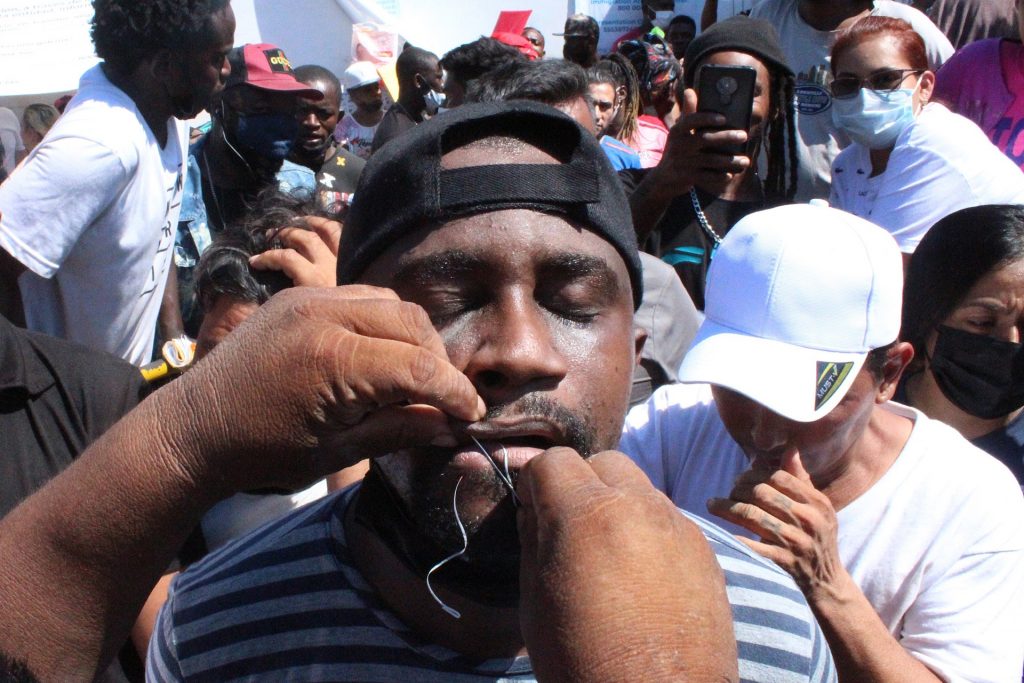 INM reprueba que migrantes se cosieran los labios para exigir visas - migrantes-boca-cosida-1024x683