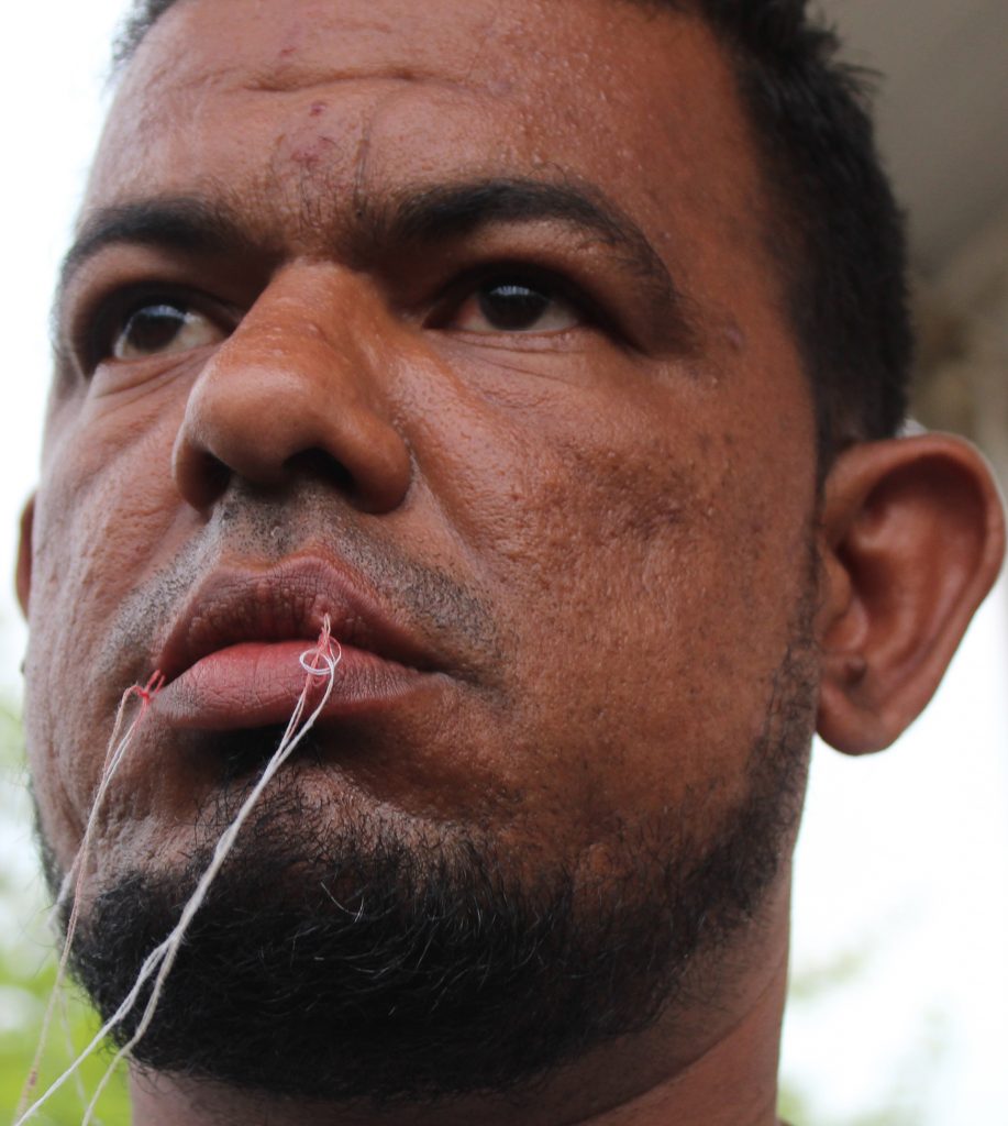 Caravana migrante presiona a autoridades en Tapachula con sutura de labios - caravana-migrante-chiapas-2-917x1024