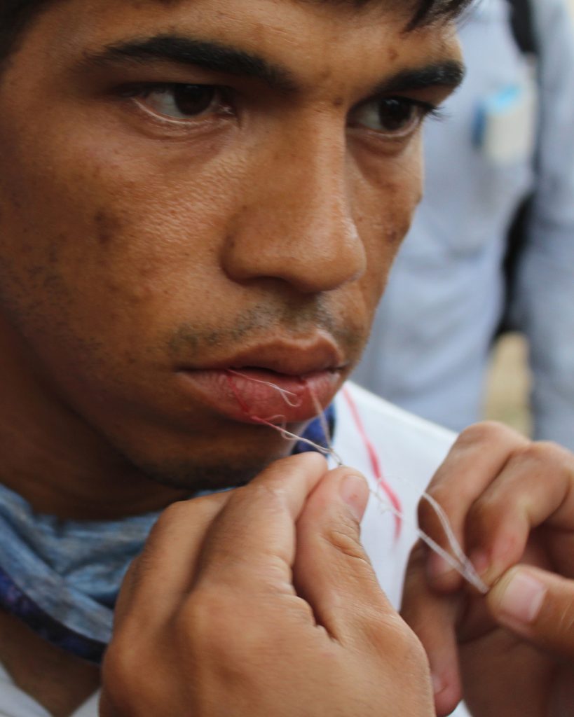 Caravana migrante presiona a autoridades en Tapachula con sutura de labios - caravana-migrante-chiapas-3-819x1024