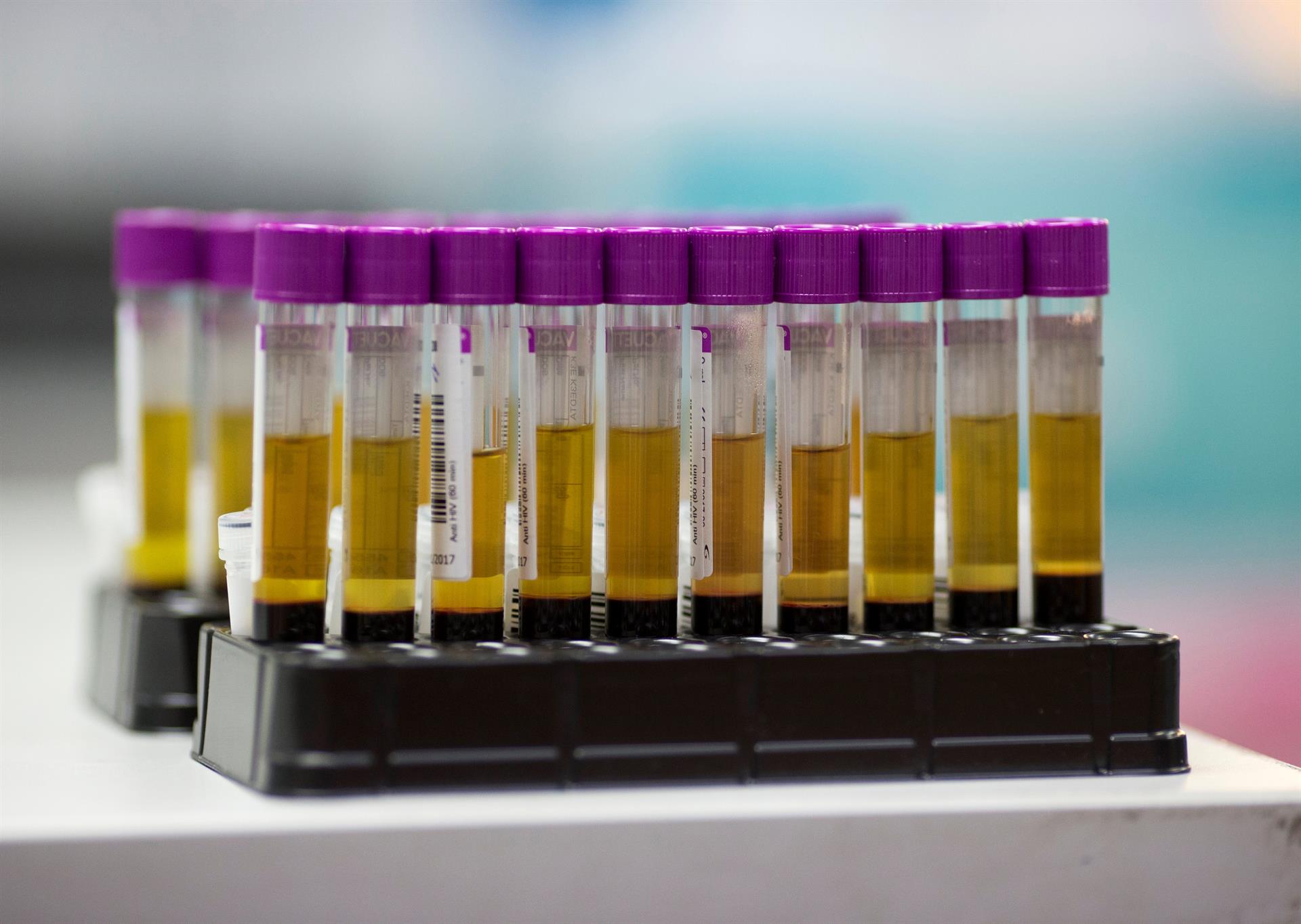 Prueban en ratones que un fármaco del VIH podría atacar la pérdida de memoria Prueban en ratones que un fármaco del VIH podría atacar la pérdida de memoria