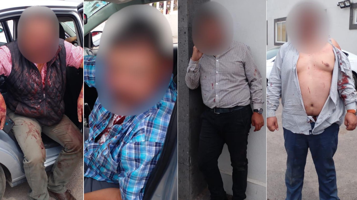 Agreden en Nopaltepec a policías de investigación de la Fiscalía de Edomex Agreden en Nopaltepec a policías de investigación de la Fiscalía de Edomex