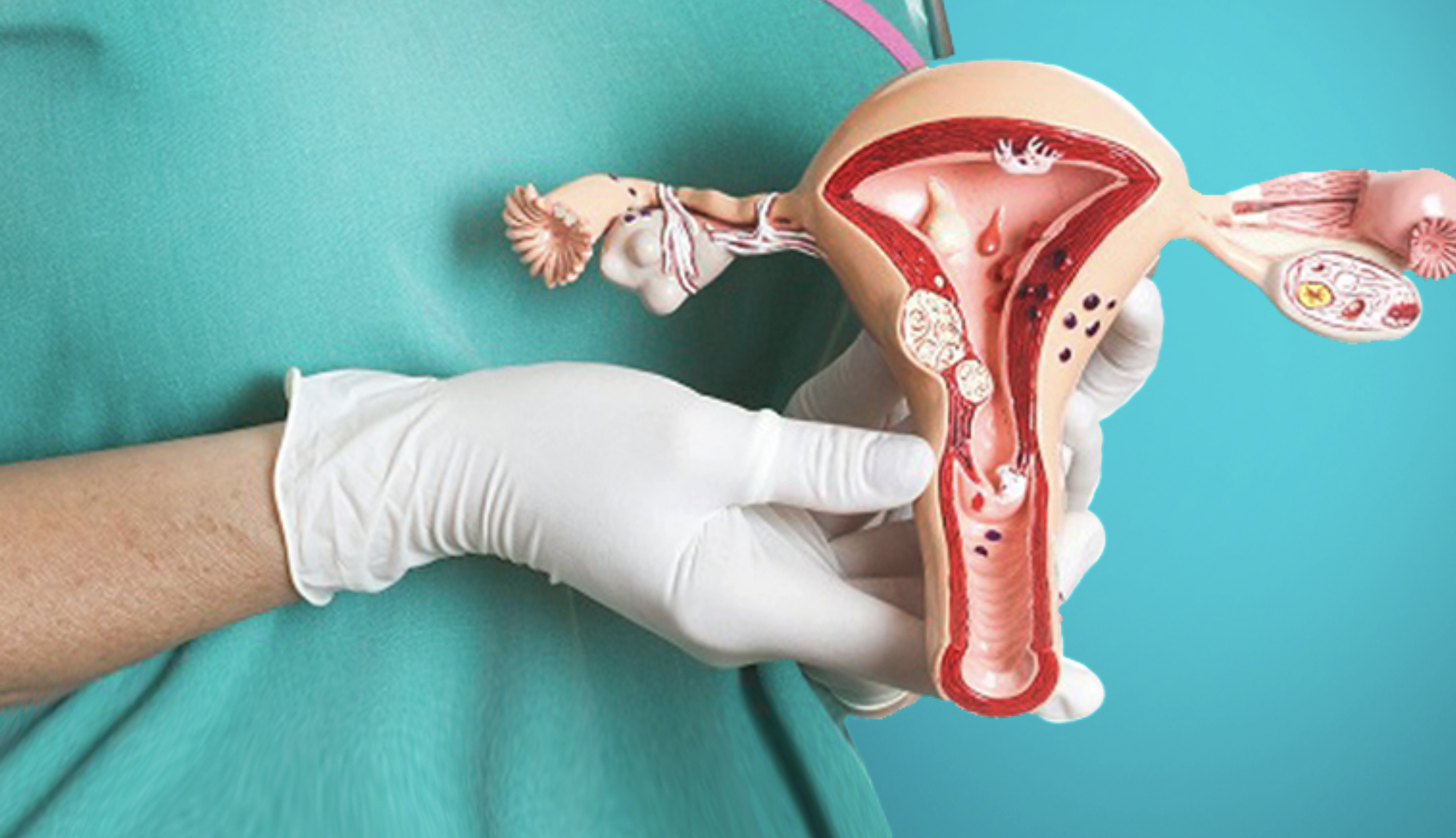 Mujeres mexicanas de 15 a 59 años en riesgo de padecer cáncer de ovario