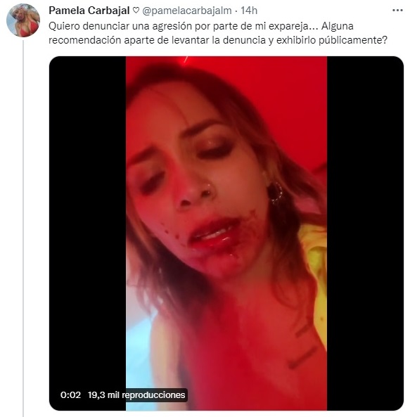#Video Modelo Pamela Carbajal denuncia agresión de su ex; "fue una pesadilla", afirma - pamela-carbajal-denuncia-agresion-de-su-exnovio