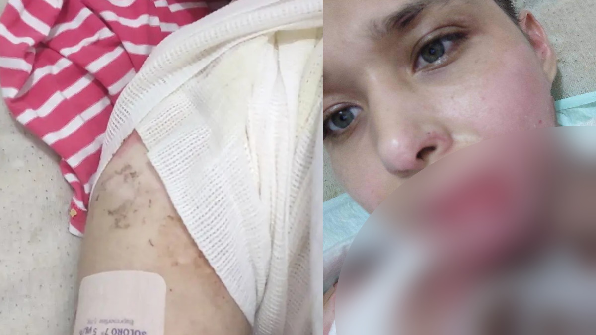 Joven de Nuevo León denuncia que fue secuestrada, violada y quemada