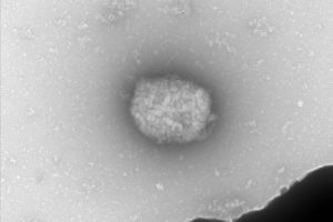 partículas viruela del mono España mpox