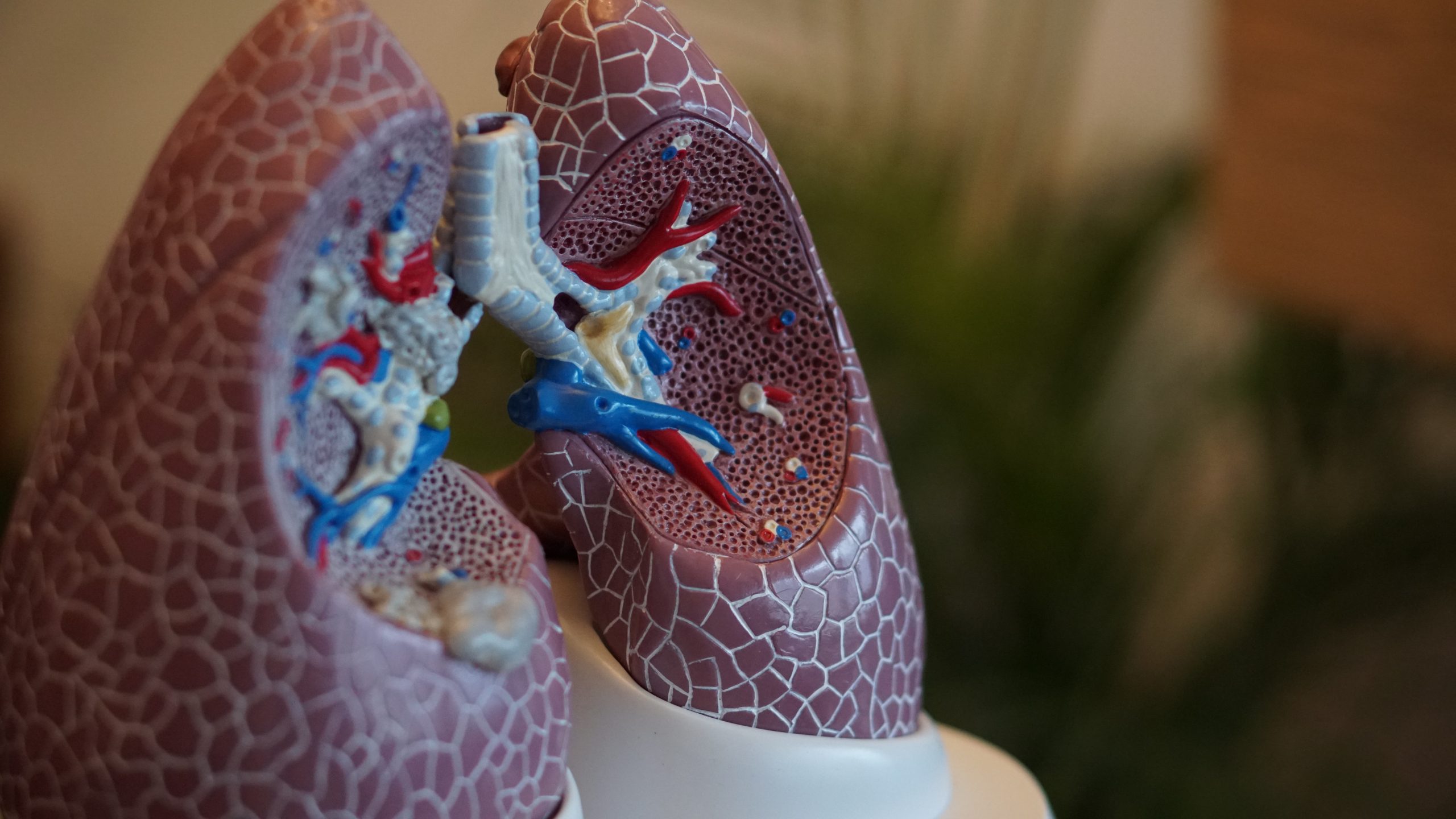 Polución provoca cáncer de pulmón en no fumadores