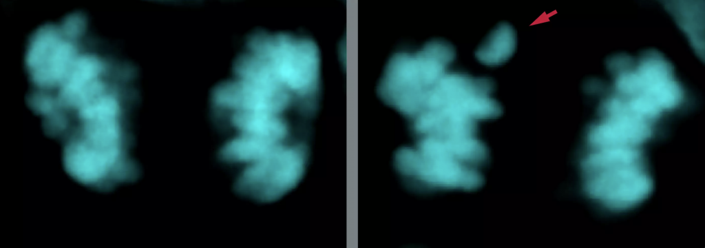 Cerebro moderno se forma más lento y con menos errores que el neandertal - cerebro-neandertales-humanos-modernos-1024x360