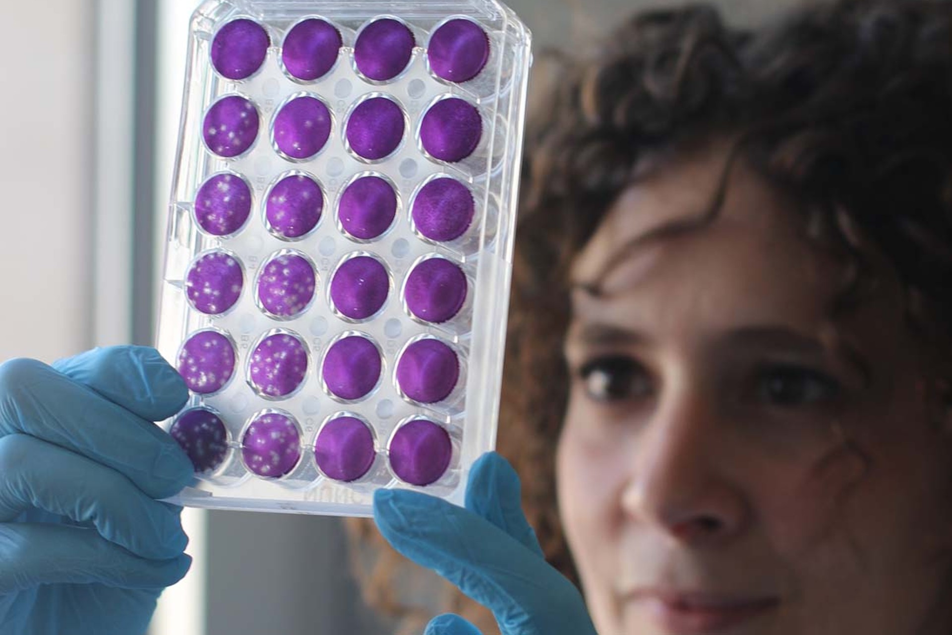 Ómicron sortea fácilmente inmunidad natural por infección de COVID-19