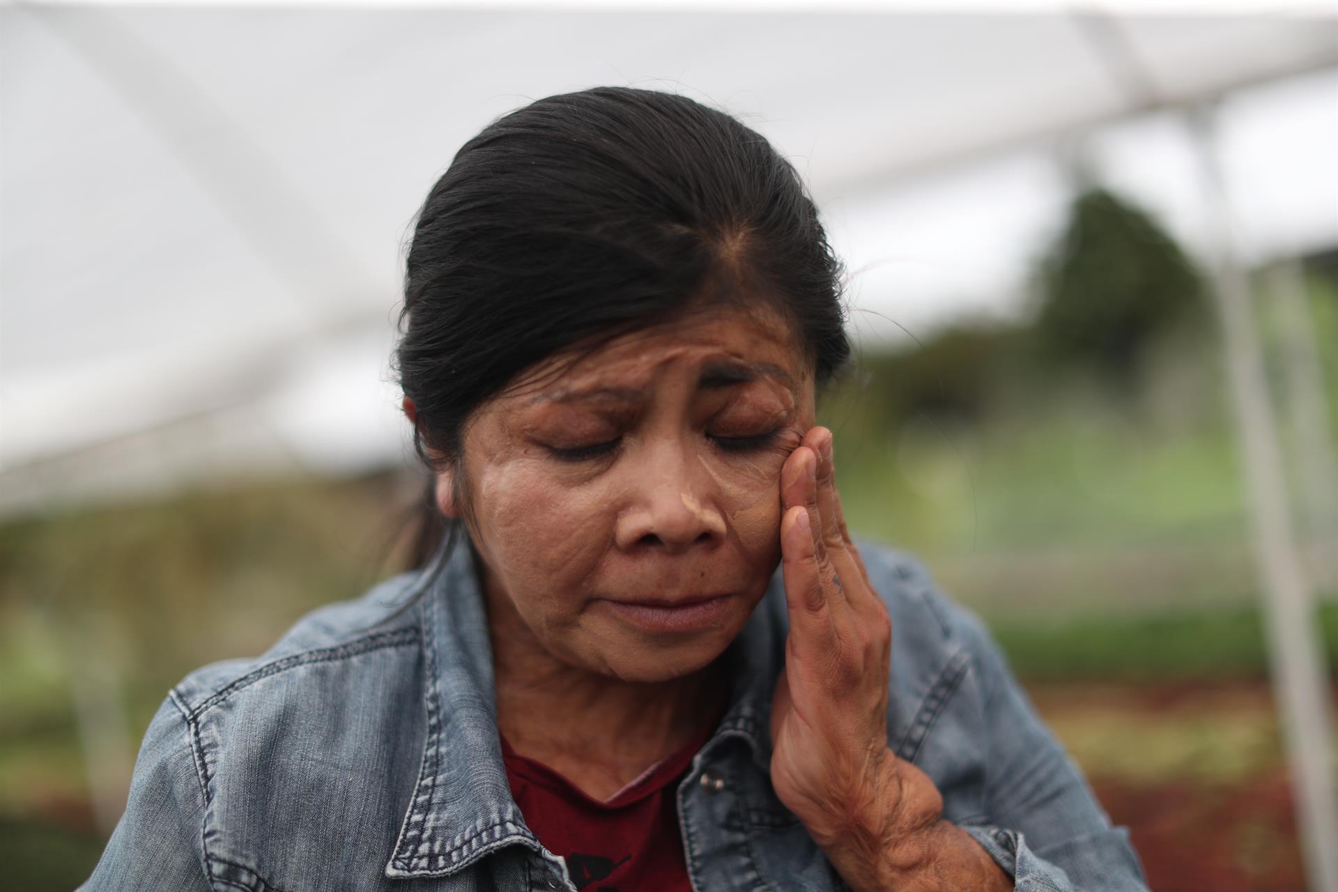 Mujeres agredidas con ácido en México, víctimas del sistema y un Estado que las olvida Mujeres agredidas con ácido en México, víctimas del sistema y un Estado que las olvida