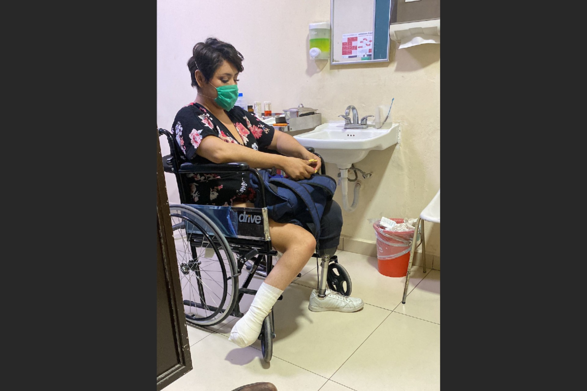 IMSS trabaja para cumplir recomendación de CNDH por caso de mujer que terminó con piernas amputadas