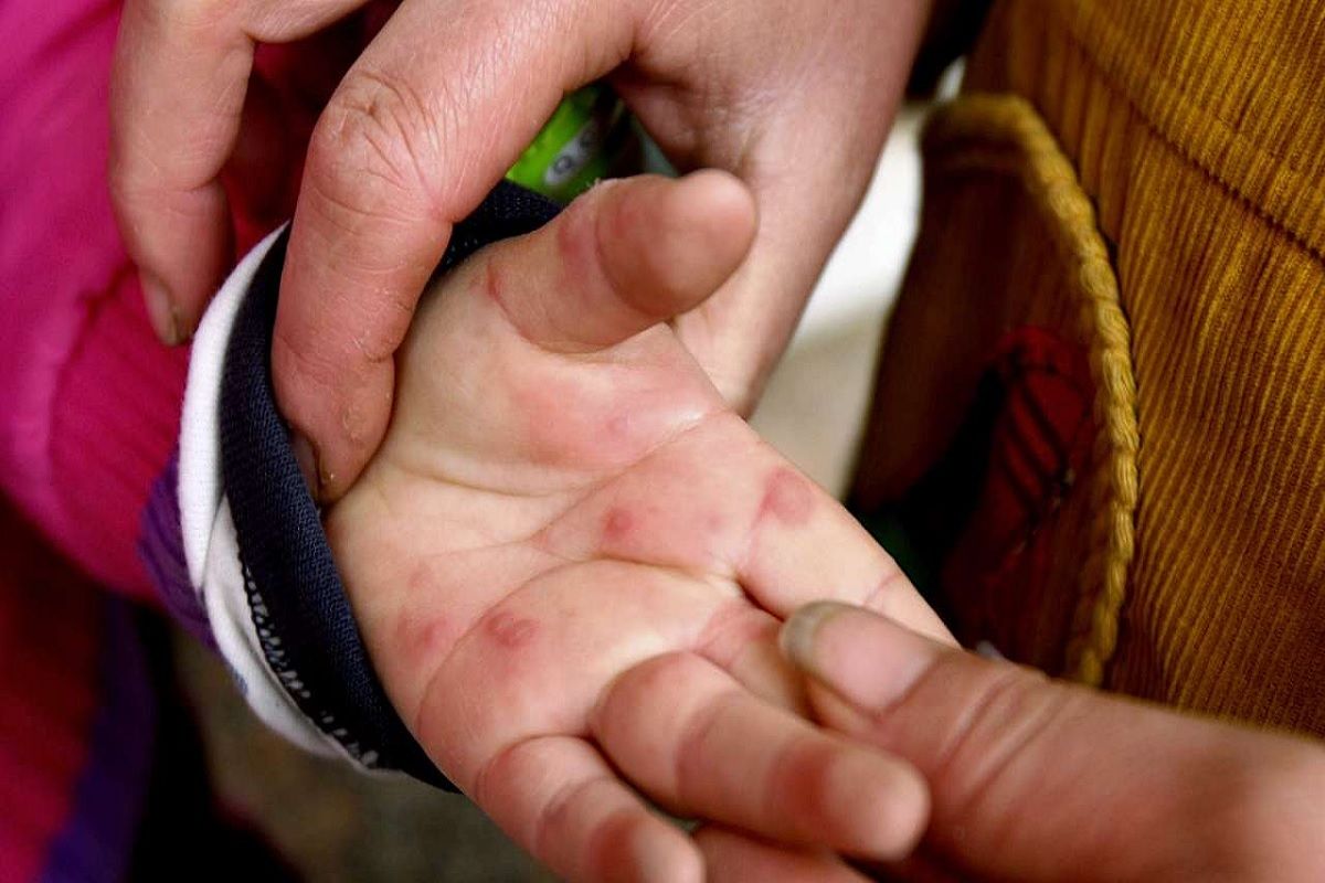 Propagación de fiebre del tomate en India provoca nueva alerta Propagación de fiebre del tomate en India provoca nueva alerta