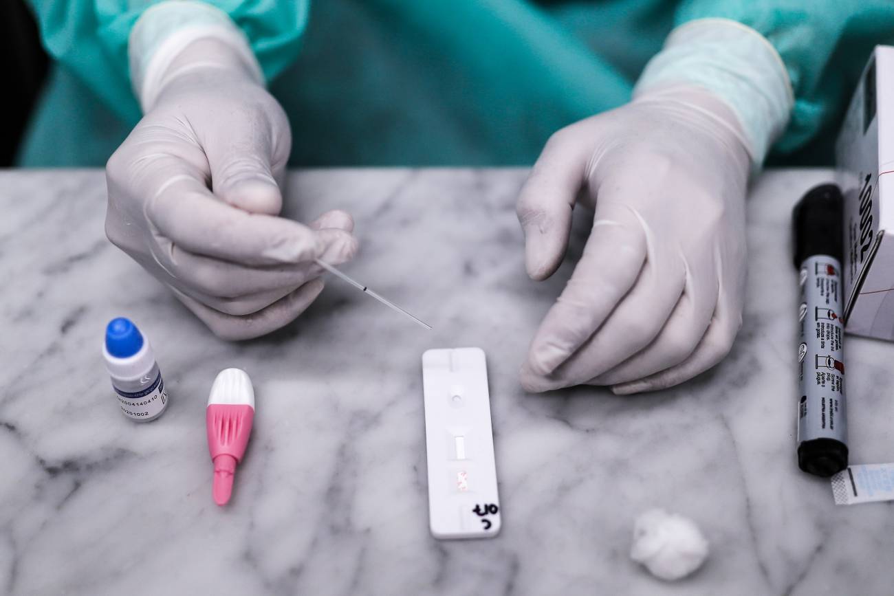 Virus de murciélago similar a COVID-19 puede entrar en las células humanas Virus de murciélago similar a COVID-19 puede entrar en las células humanas