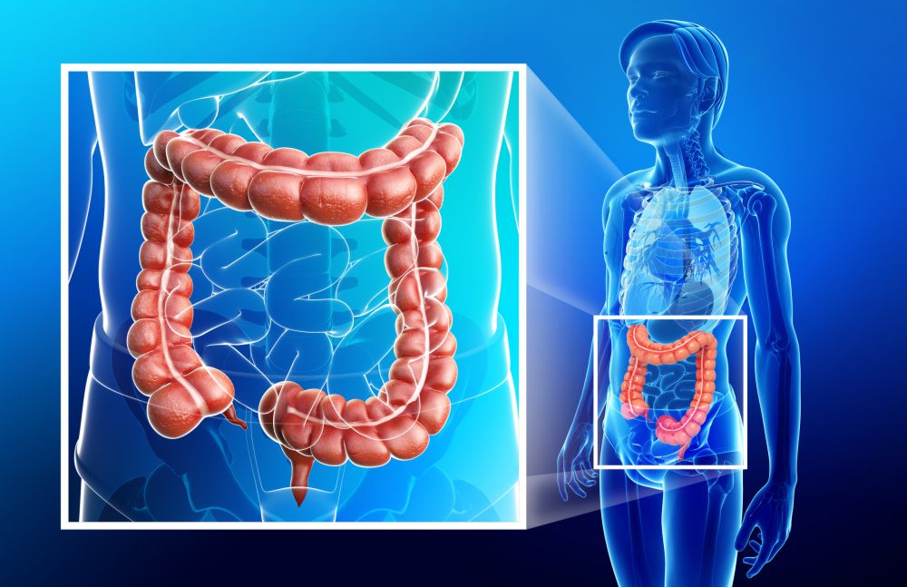 Identifican un nuevo gen clave para el crecimiento del cáncer de colon
