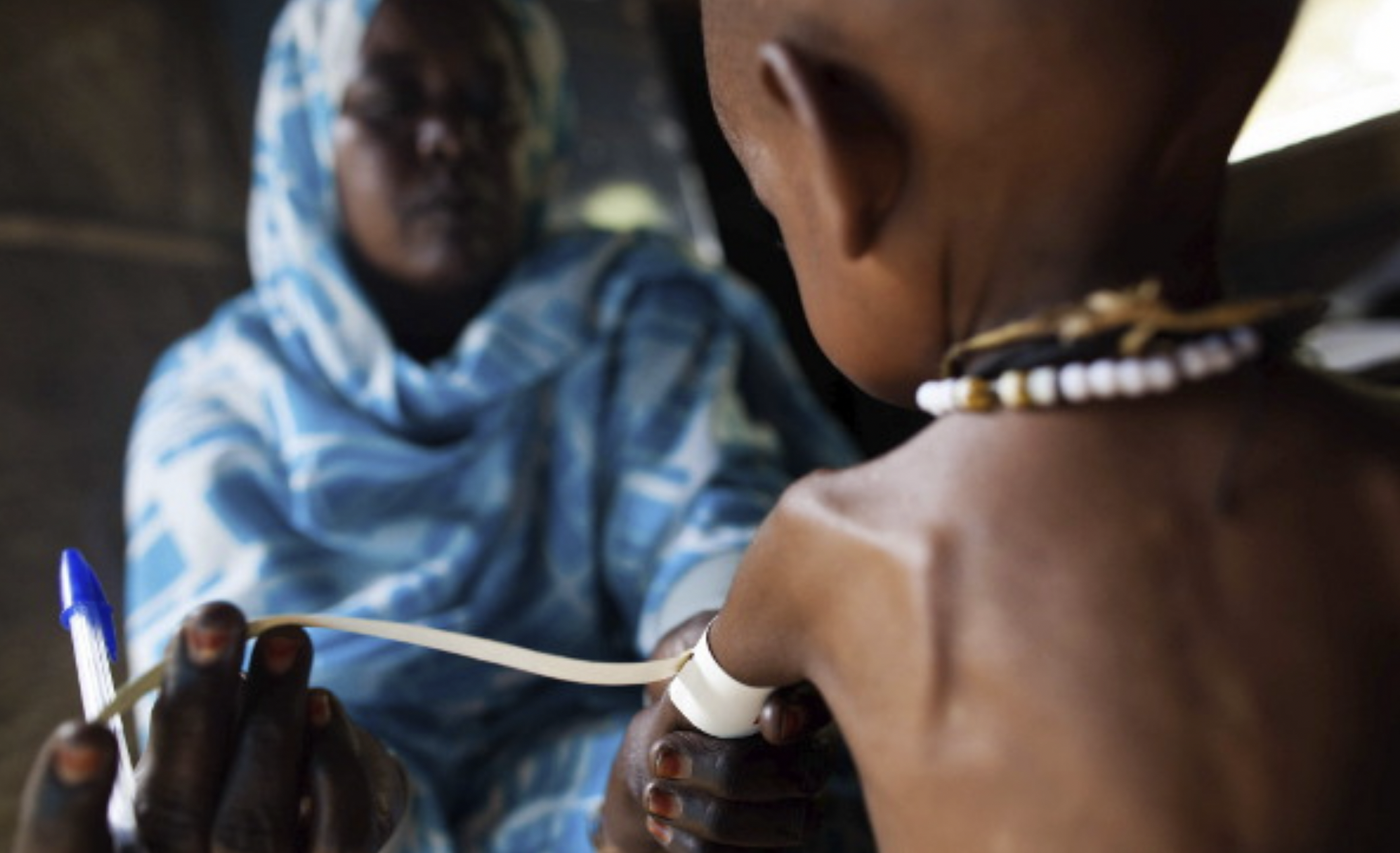 Más de 750 millones de personas están desnutridas en el mundo Más de 750 millones de personas están desnutridas en el mundo