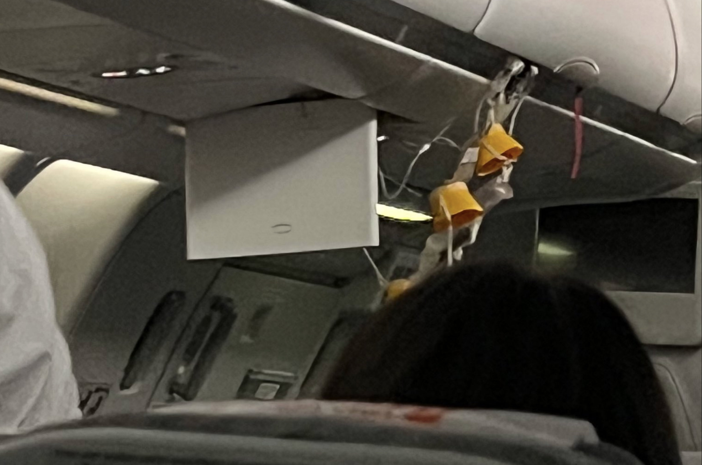 Turbulencia durante vuelo con destino a Buenos Aires deja 12 heridos Turbulencia durante vuelo con destino a Buenos Aires deja 12 heridos