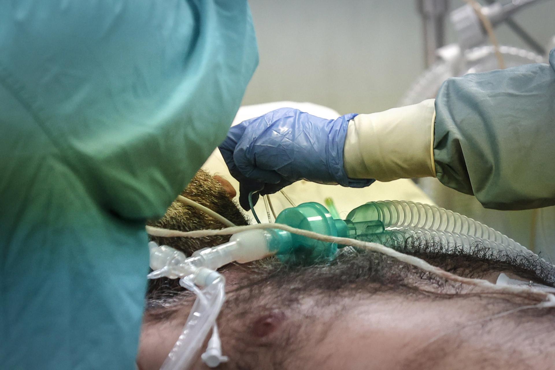 Exceso de mortalidad por COVID-19 es tres veces más de lo estimado