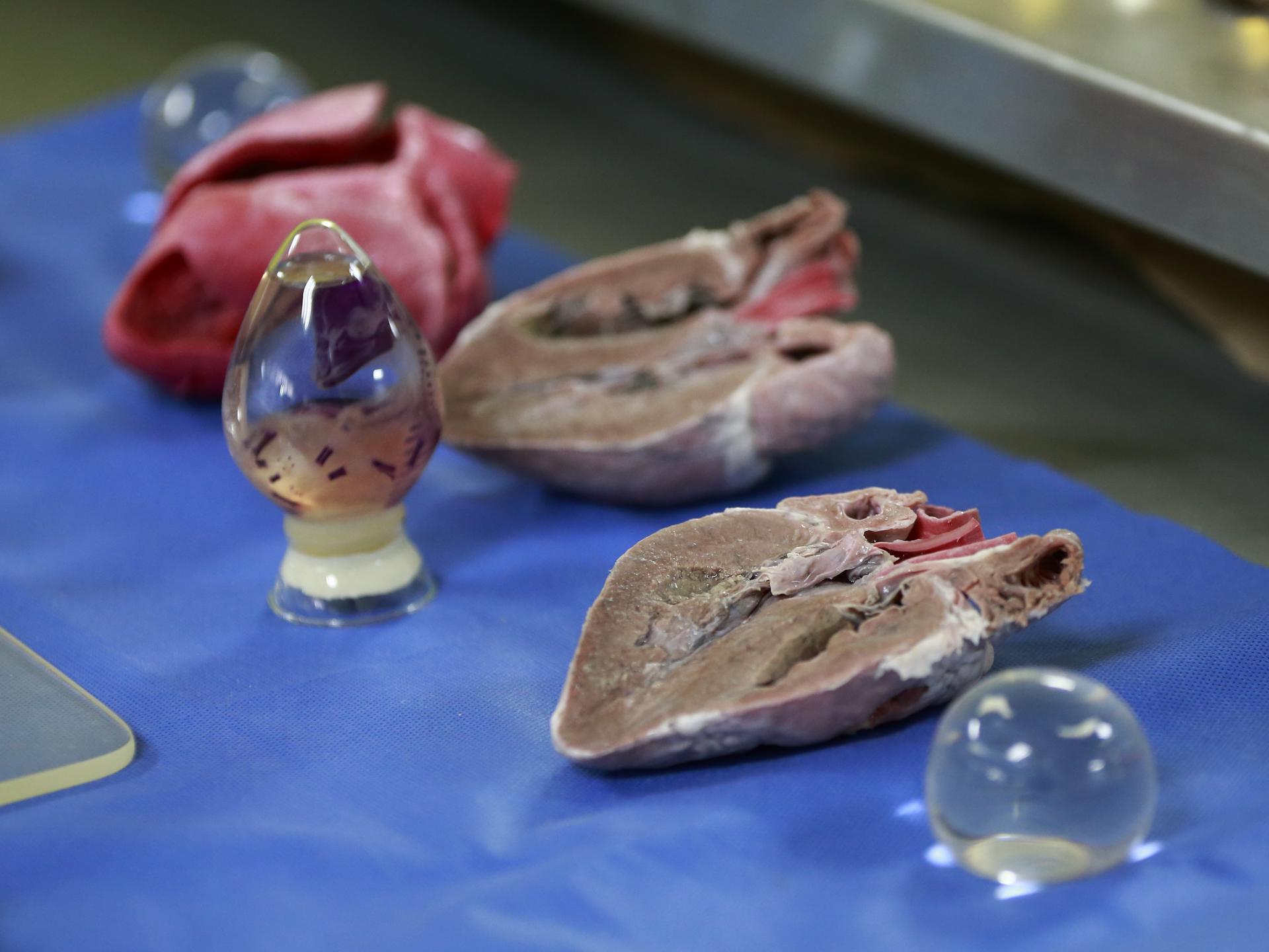 Donación de órganos en México aumentó un 40 % en 2022 Donación de órganos en México aumentó un 40 % en 2022