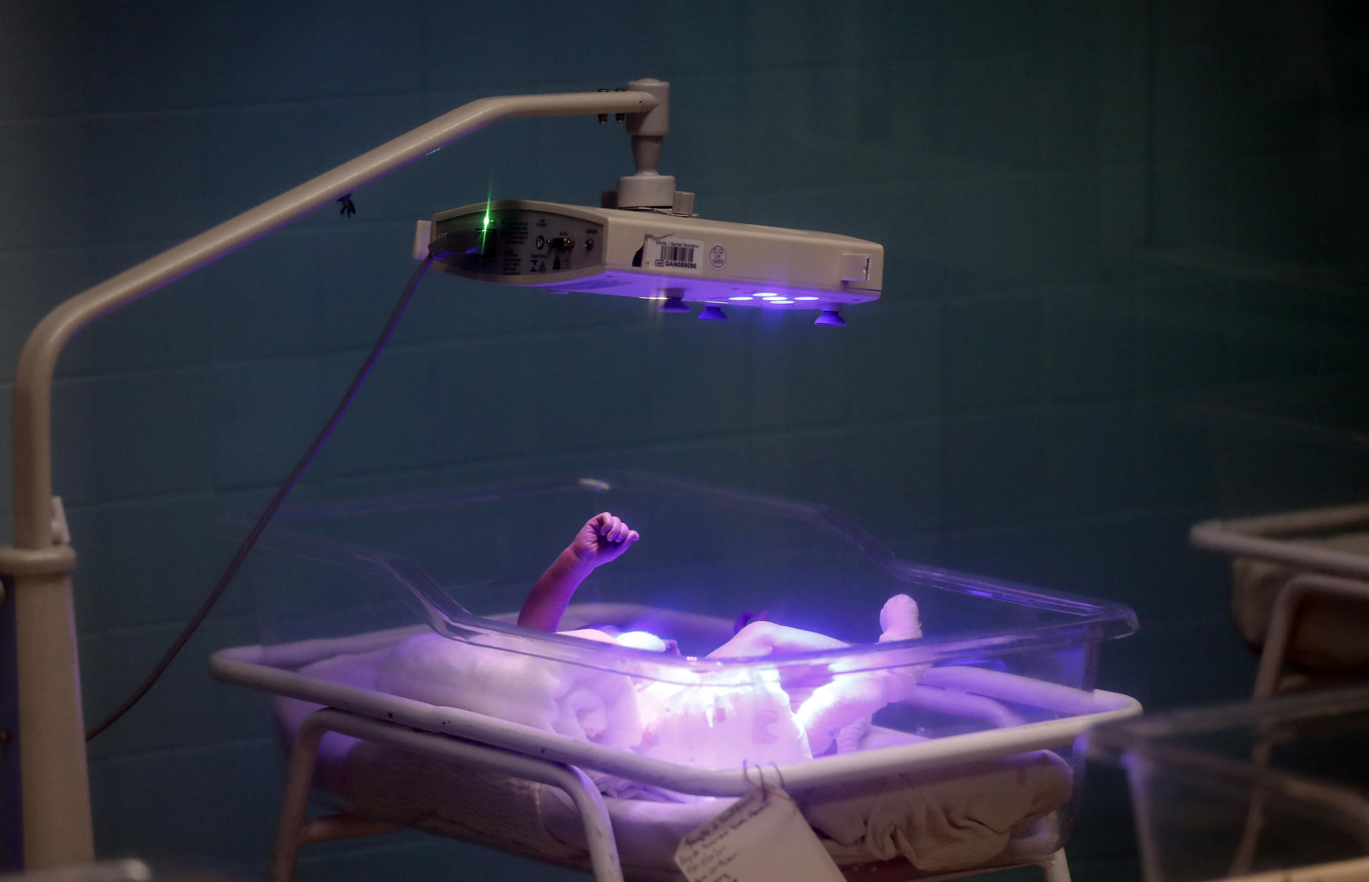 Partos prematuros bajaron ligeramente al inicio de los confinamientos