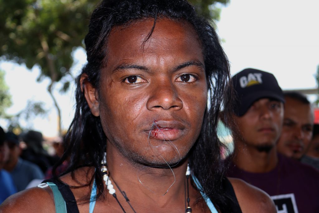 Migrantes en caravana se cosen los labios para presionar al INM - migrantes-se-cosen-los-labios-1024x683