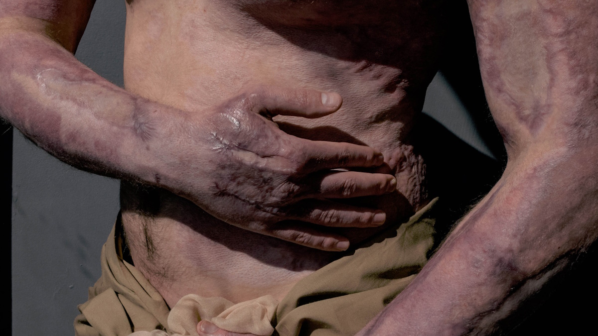 Fotógrafa ucraniana convierte en belleza y respeto los cuerpos mutilados de los soldados