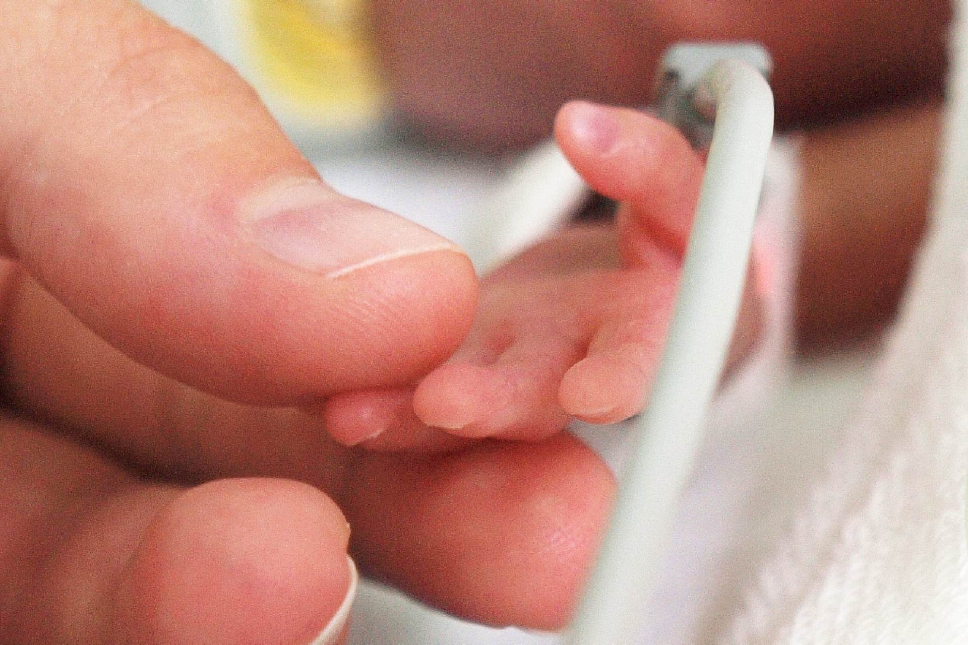 Nacimientos prematuros son la principal causa de mortalidad infantil Nacimientos prematuros son la principal causa de mortalidad infantil