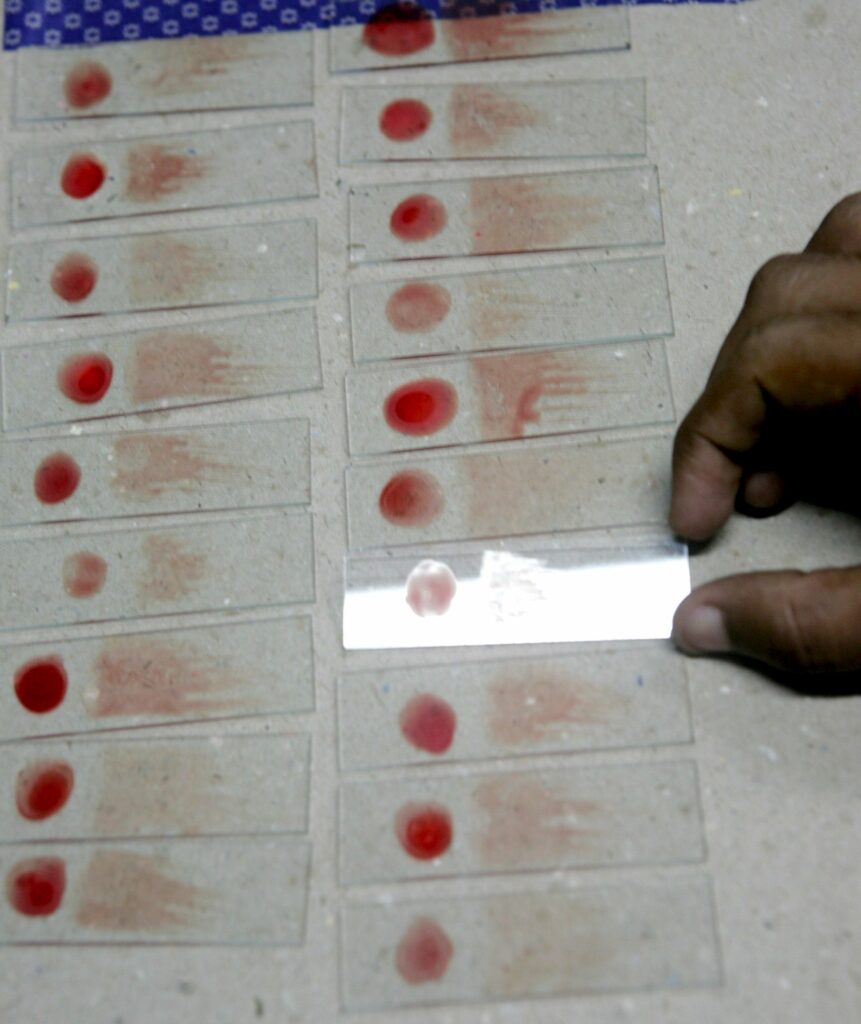 Estados Unidos en alerta ante varios casos de transmisión local de malaria - malaria-861x1024