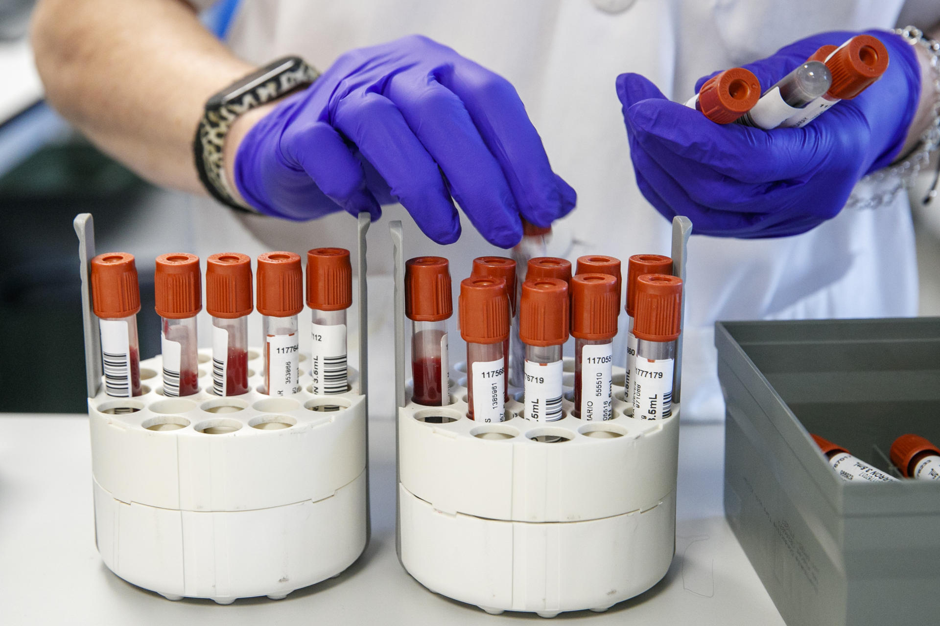 Hepatitis podría ser más letal que malaria, tuberculosis y sida en 2040: OMS Hepatitis podría ser más letal que malaria, tuberculosis y sida en 2040: OMS