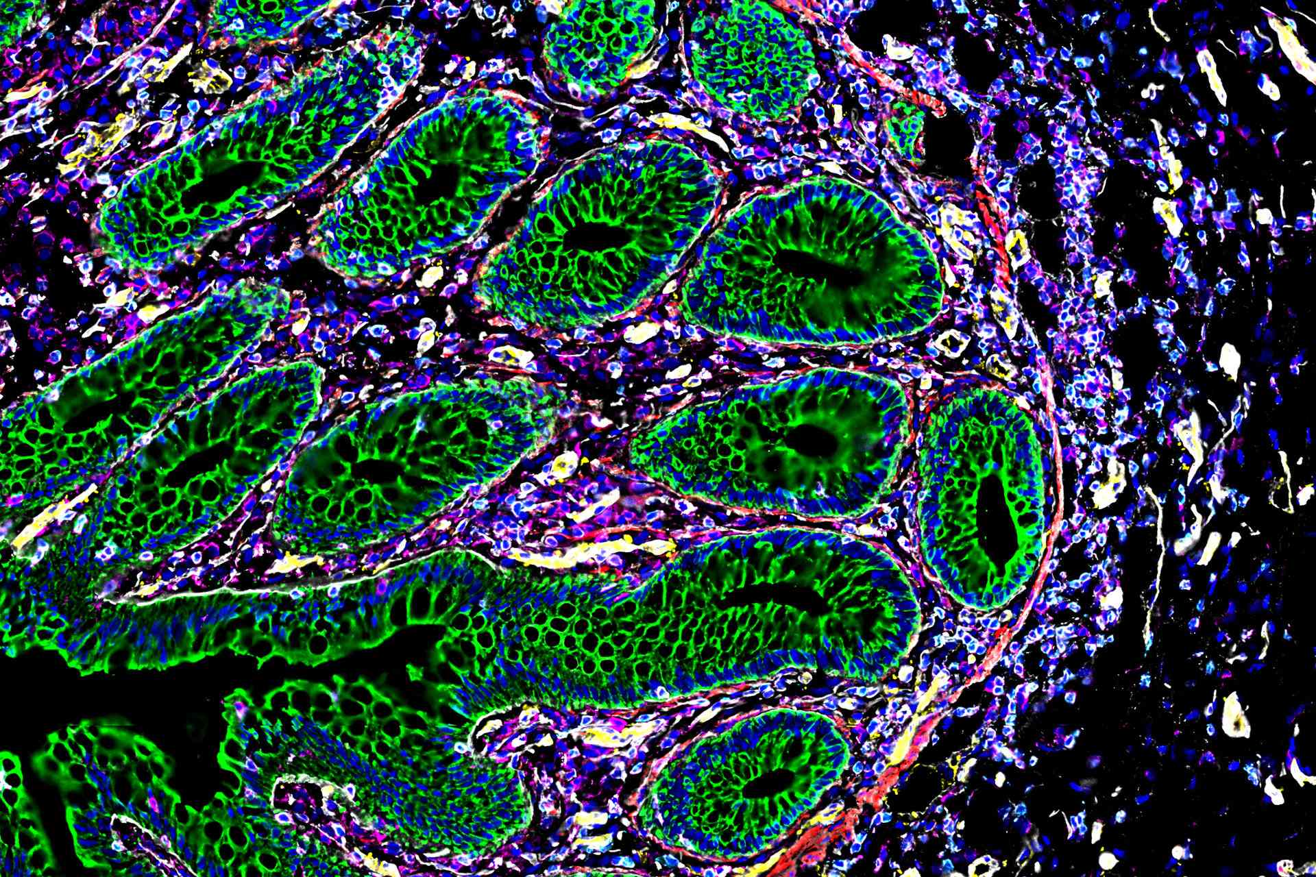 Nuevos mapas del cuerpo humano a nivel celular para entender mejor la salud y la enfermedad