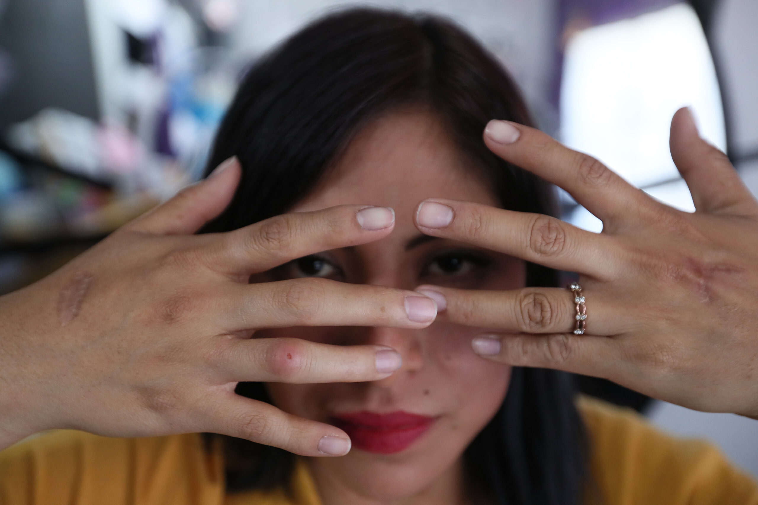 “Vivir sin miedo”, el reto de una víctima de intento de feminicidio en México