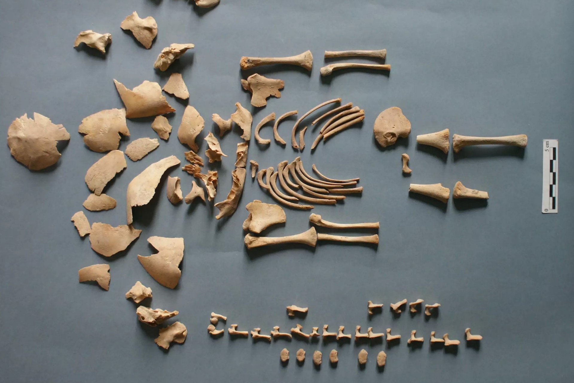 Bebés con síndrome de Down eran enterrados con estatus especial en la Edad del Hierro