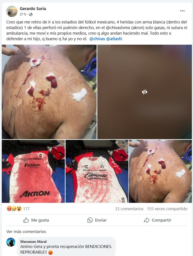 Aficionado de Atlas denuncia agresión en estadio Akron - aficionado-de-atlas-denuncia-agresion-en-estadio-akron-2-771x1024