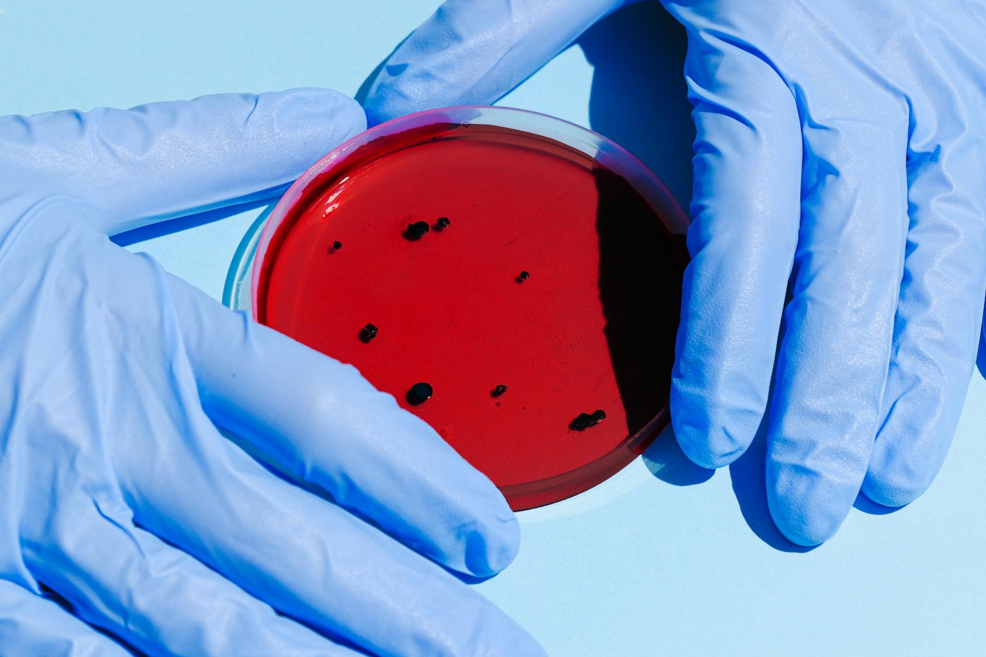 Bacteria Klebsiella Oxytoca: ¿cuáles son sus síntomas?