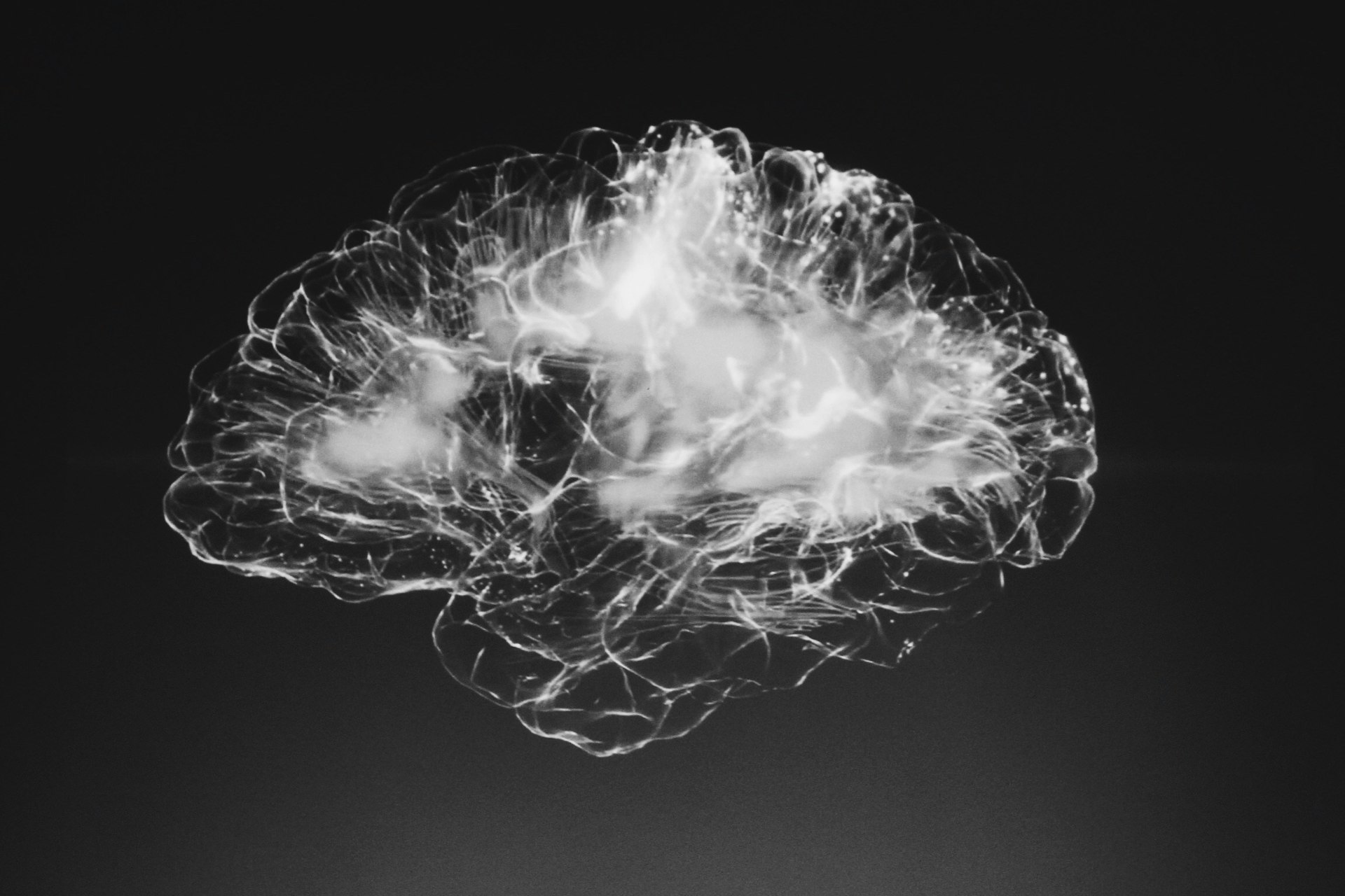 Los cerebros envejecieron más rápido en pandemia de COVID-19, incluso en las personas no infectadas Los cerebros envejecieron más rápido en pandemia de COVID-19, incluso en las personas no infectadas