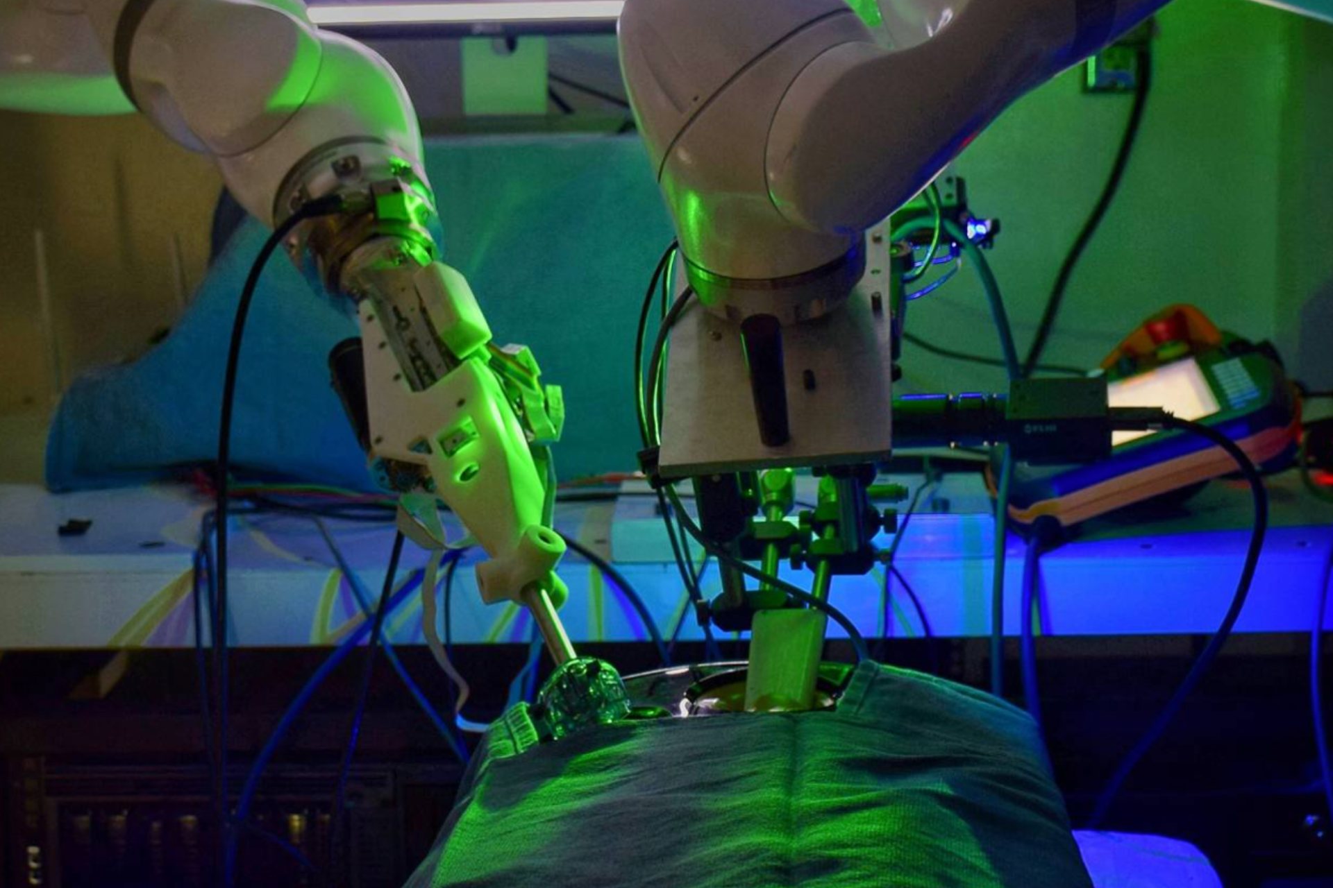 Un robot entrenado con IA y vídeos de cirugías opera una vesícula biliar sin ayuda humana Un robot entrenado con IA y vídeos de cirugías opera una vesícula biliar sin ayuda humana