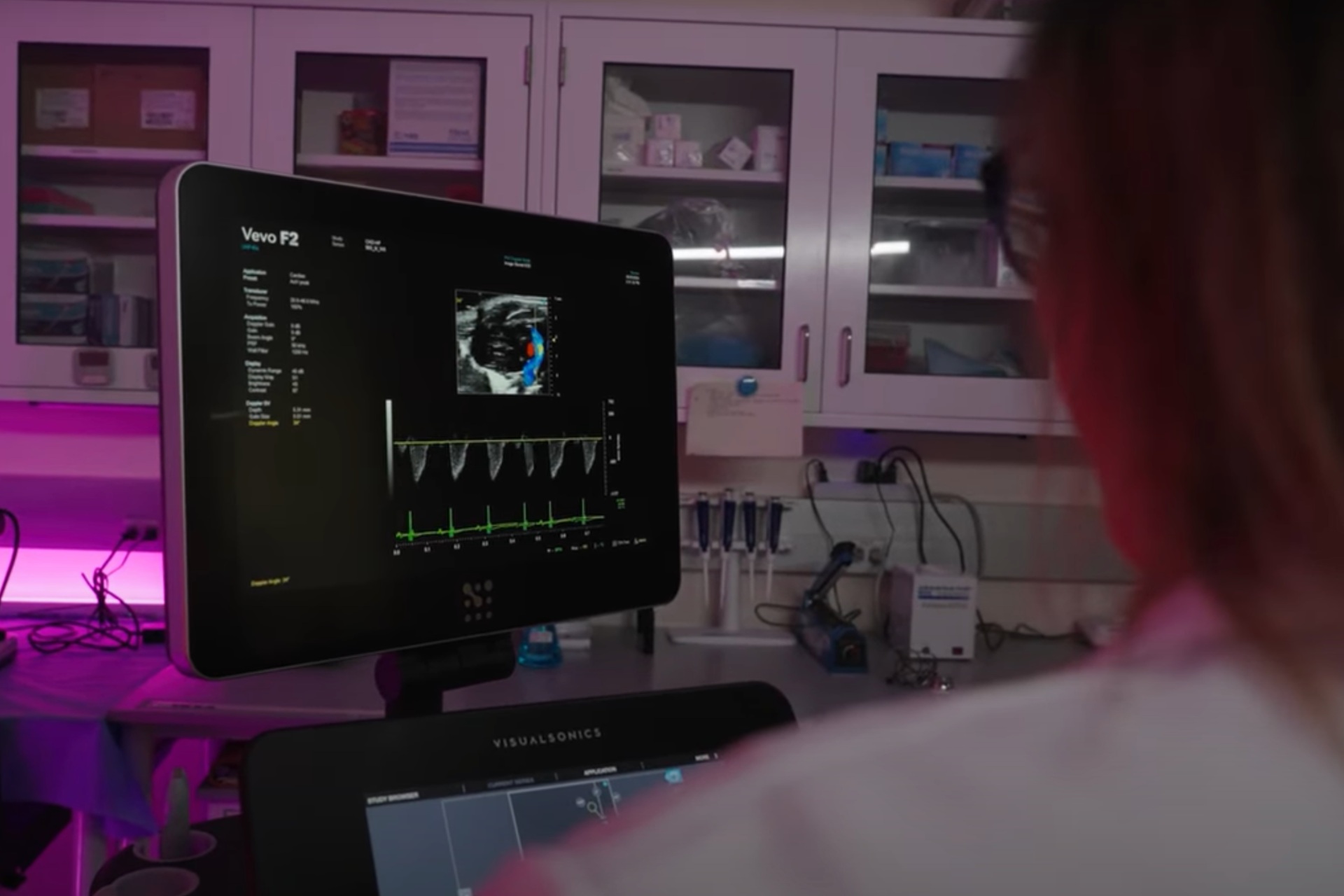 Científicos de EE.UU. crean una IA que busca prevenir infartos oyendo los latidos