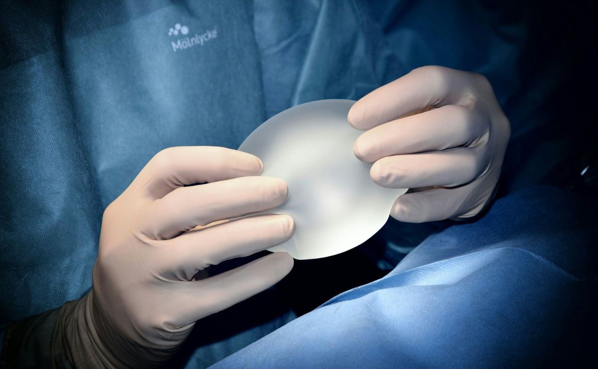 Caso Paloma Nicole: ¿A qué edad se puede hacer una cirugía plástica en México?