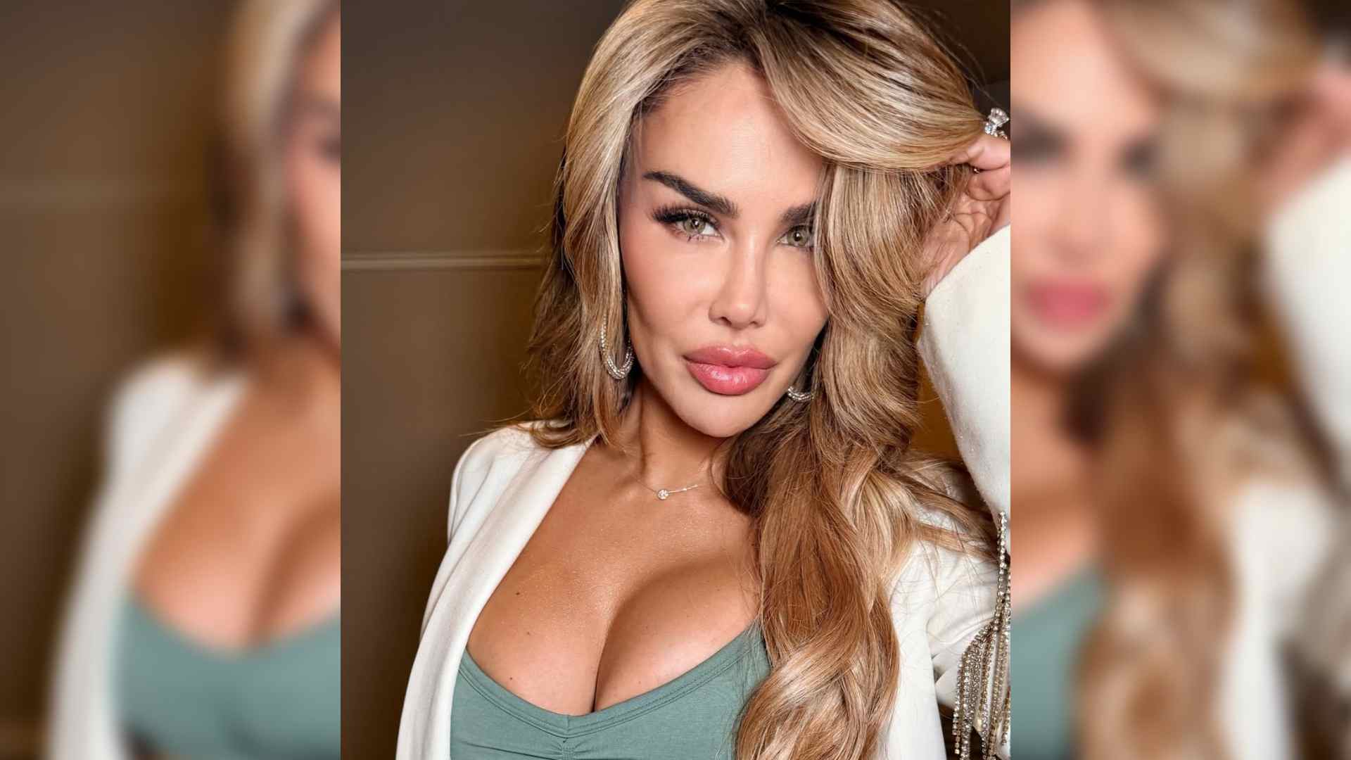 Ninel Conde se somete a cirugía para cambiar el color de sus ojos