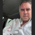 Atentan contra candidato presidencial peruano Rafael Belaúnde