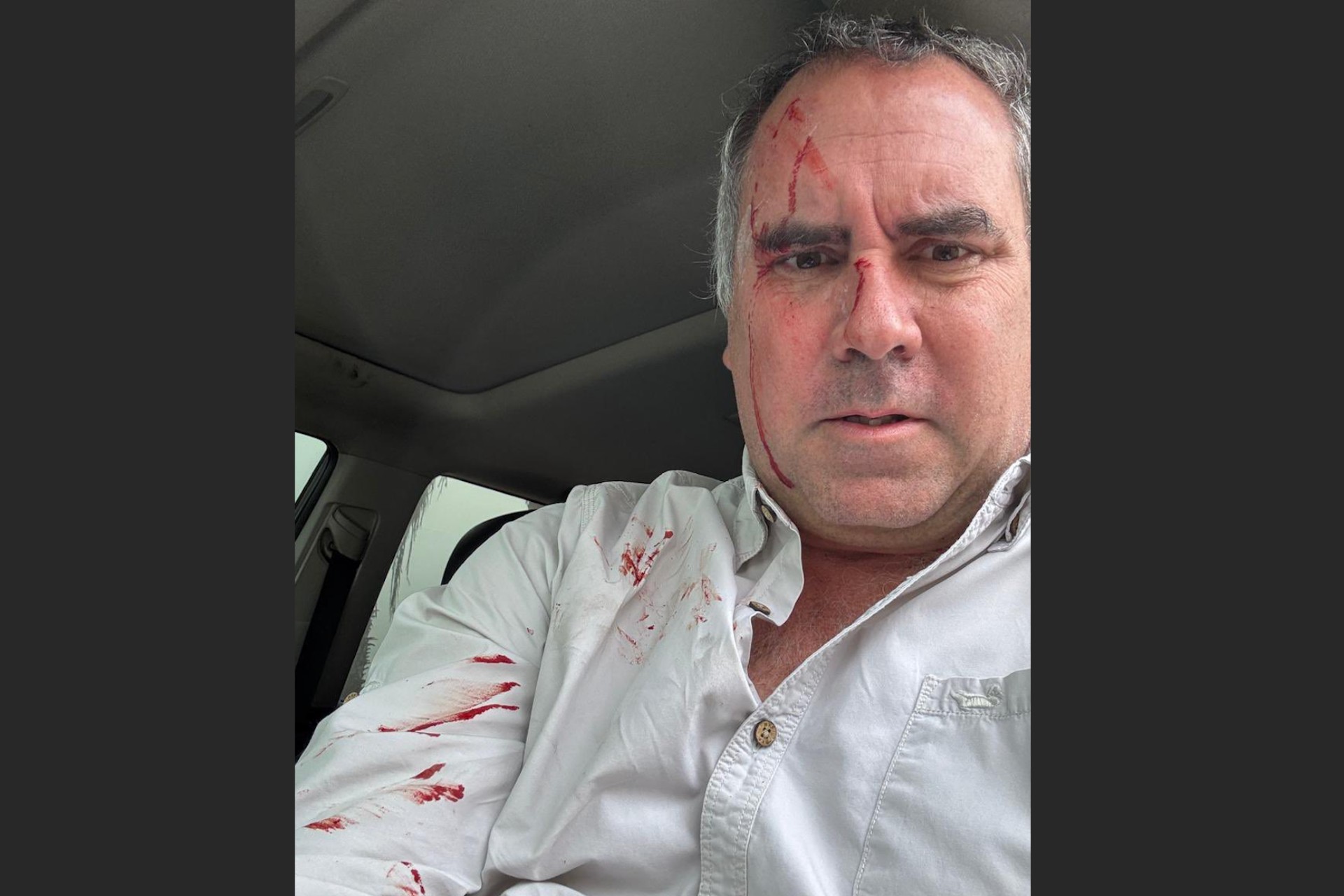 Atentan contra candidato presidencial peruano Rafael Belaúnde Atentan contra candidato presidencial peruano Rafael Belaúnde