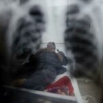 Dos casos de tuberculosis en el mayor centro de detenci&oacute;n para migrantes de EE.UU.